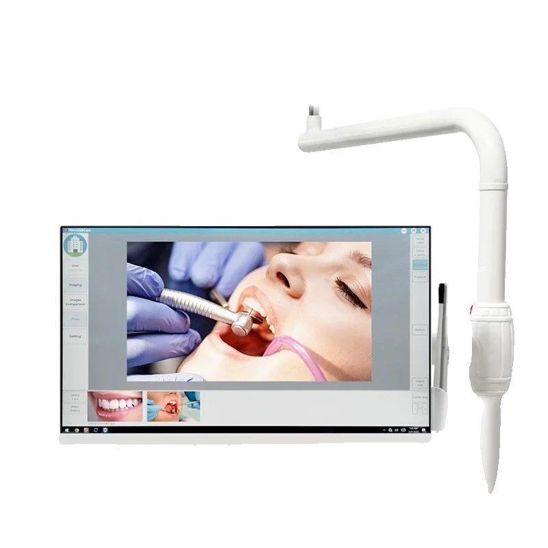 Zahnendoskopkamera, Hochauflösender Monitor, Drahtlose Konnektivität, 220v Eu-stecker 45mm