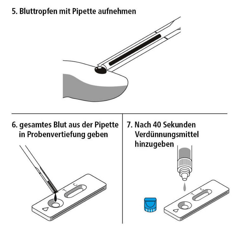 siegmund care Unverträglichkeitstest Glutenunverträglichkeit Selbsttest, Dauer des Tests :15 Minuten, 1-tlg., Genauigkeit 96,7 % Bild 3