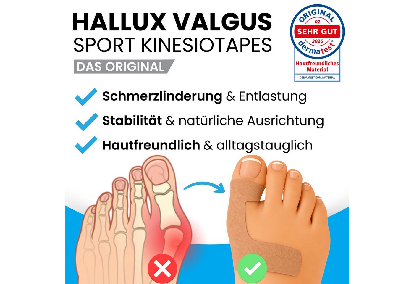 Sanmedix Kinesiologie-Tape Hallux Valgus Precut Kinesiotapes Vorgeschnitten bei Ballenzeh, atmungsaktiv, hautfreundlich, latexfrei Bild 5