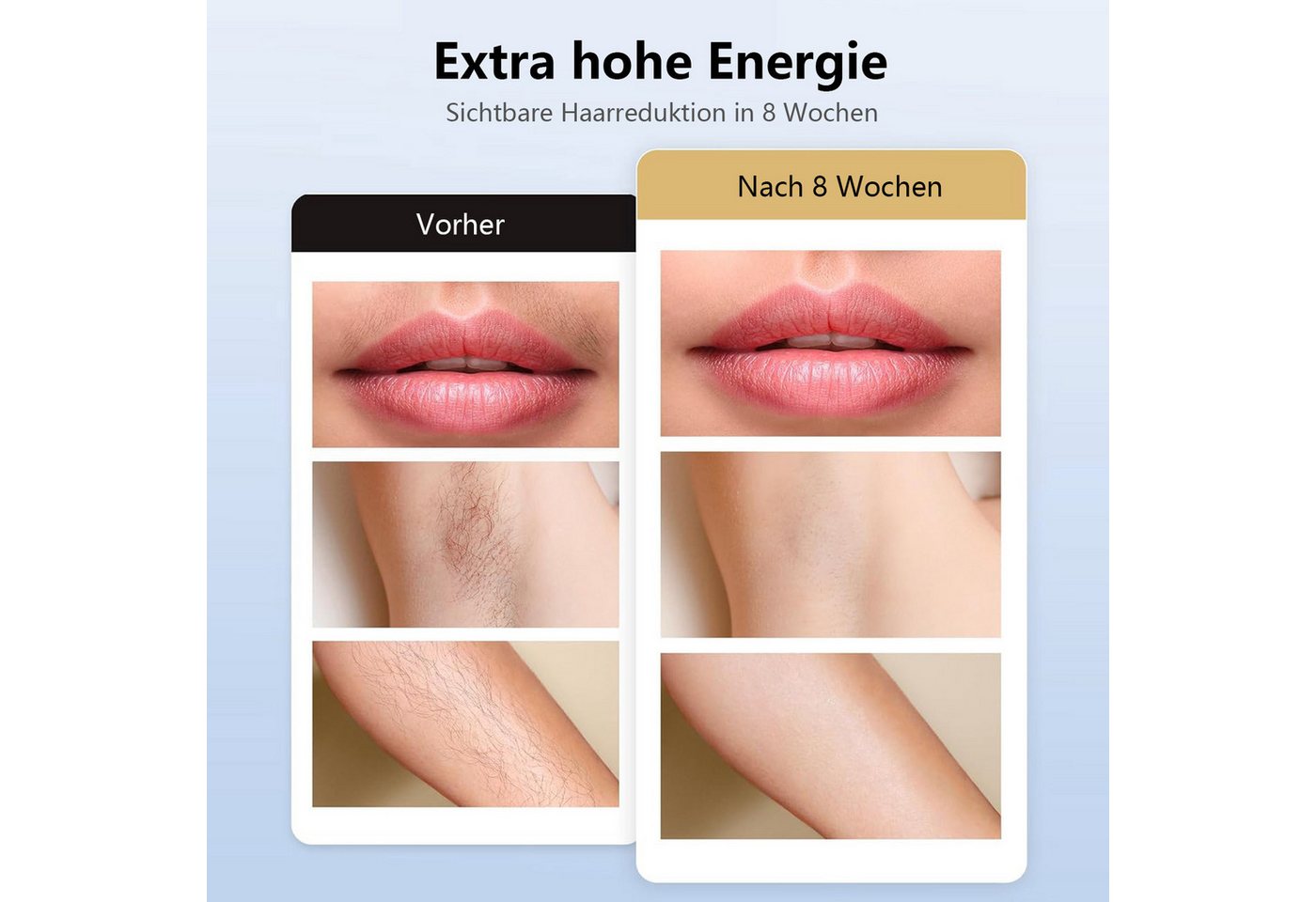 Futicare IPL-Haarentferner mit Gefrierfunktion, 9 Energiestufen, Auto & Manuell, LCD-Display, 999.999 Blitze für Zuhause Lichtimpulse Bild 5