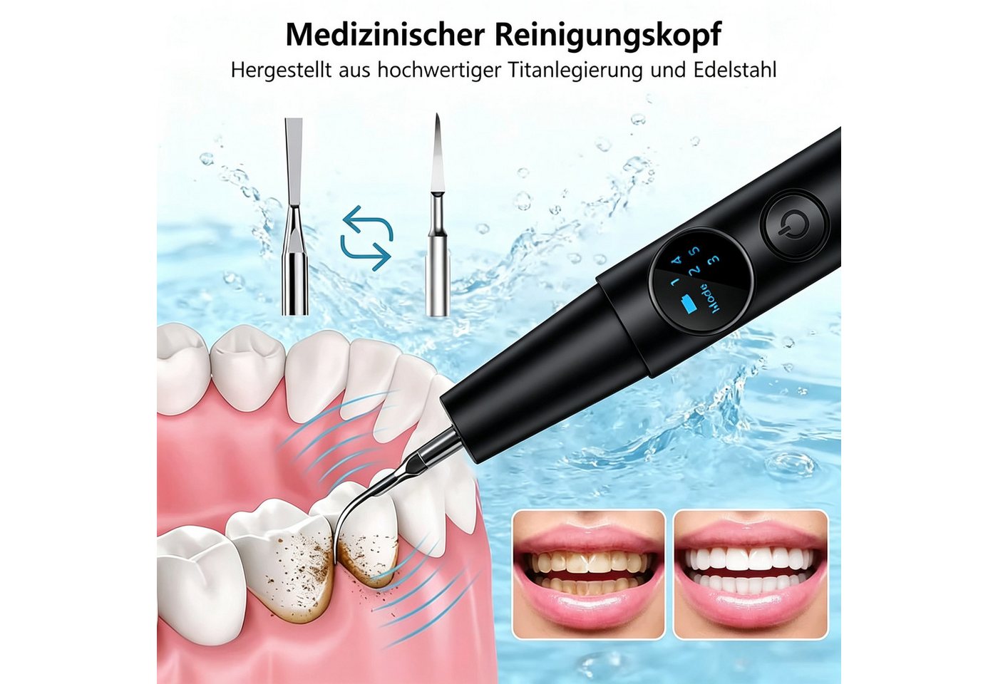 wohnTRAUM24 Zahnpflege-Set Zahnsteinentferner Zahnreinigung Set, mit 5 Modi und 2 Reinigungsköpfe, Zahnpflege-Set Zahnsteinentferner mit LED-Licht 2 Edelstahlaufsätzen, Zahnreinigung Set mit LED Licht für Zahnstein Entfernen mensch Bild 5