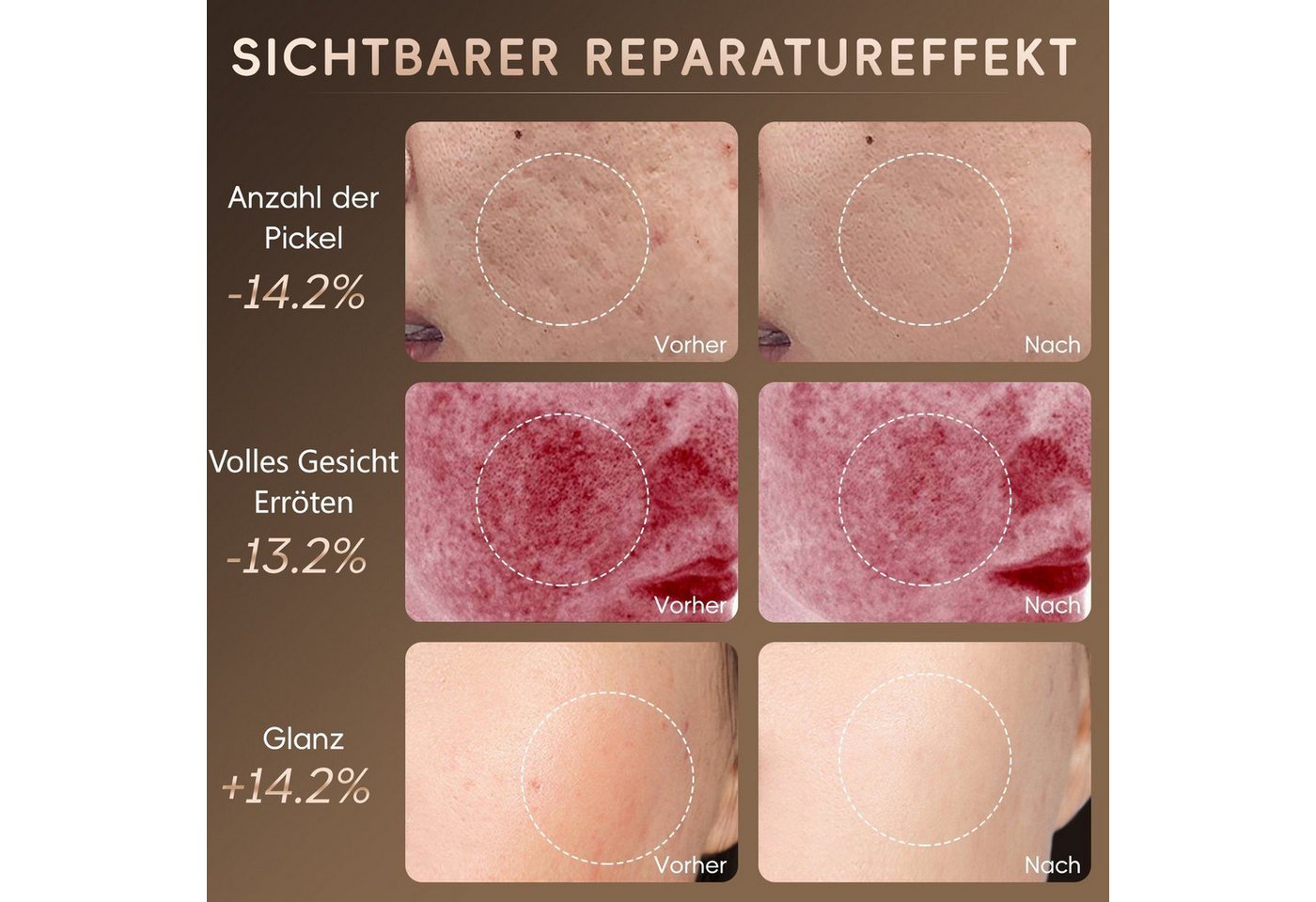 feinlux Kosmetikbehandlungsgerät Kosmetikbehandlungsgerät LED Gesichtsmaske mit 7 Lichtfarben, Packung, Photonic Facial Mask Meter, für alle Hauttypen geeignet Bild 4