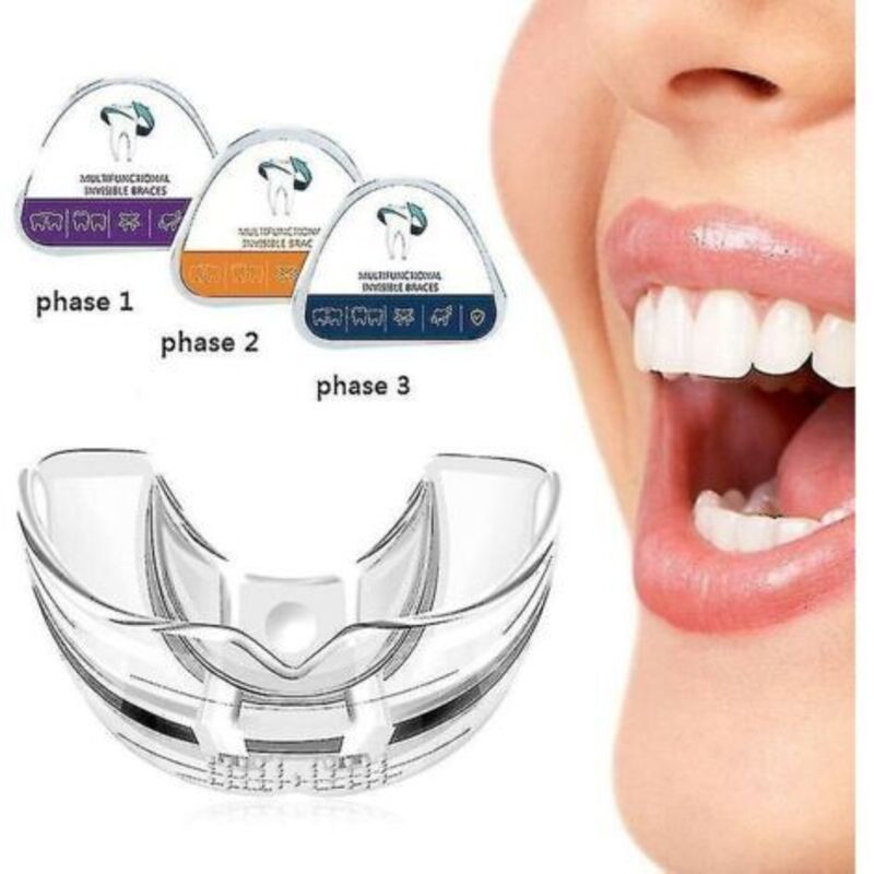 Correcteur Dentaire Orthodontique Transparent – 3 Phases D1/d2/d3 – Matériau Tpu Pour Alignement Des Dents – Solution Discrète Pour Adultes