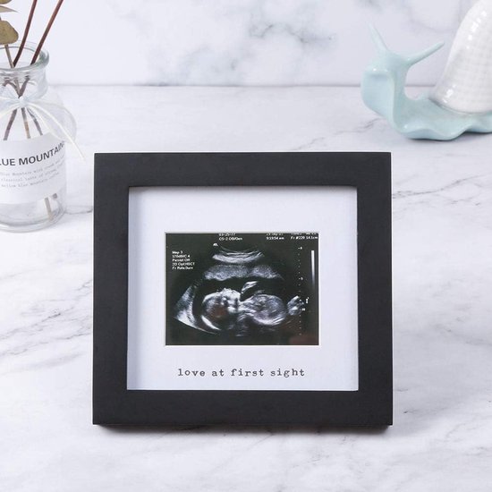 Schwarzer Baby Ultraschall Bilderrahmen Mit Silberner Schrift Bilderrahmen Für Das Erste Ultraschallbild Ideales Geschenk Für Werdende Eltern, Ba