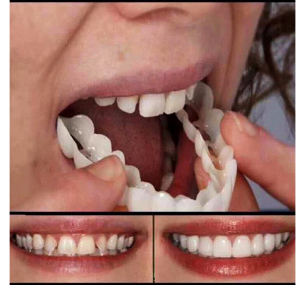 HT Zahnschutz Zahnblende zum Aufstecken für obere und untere Zähne, falsche Zähne, perfektes Lächeln,Flexible Zahnspange,Weißen der Zähne Bild 4