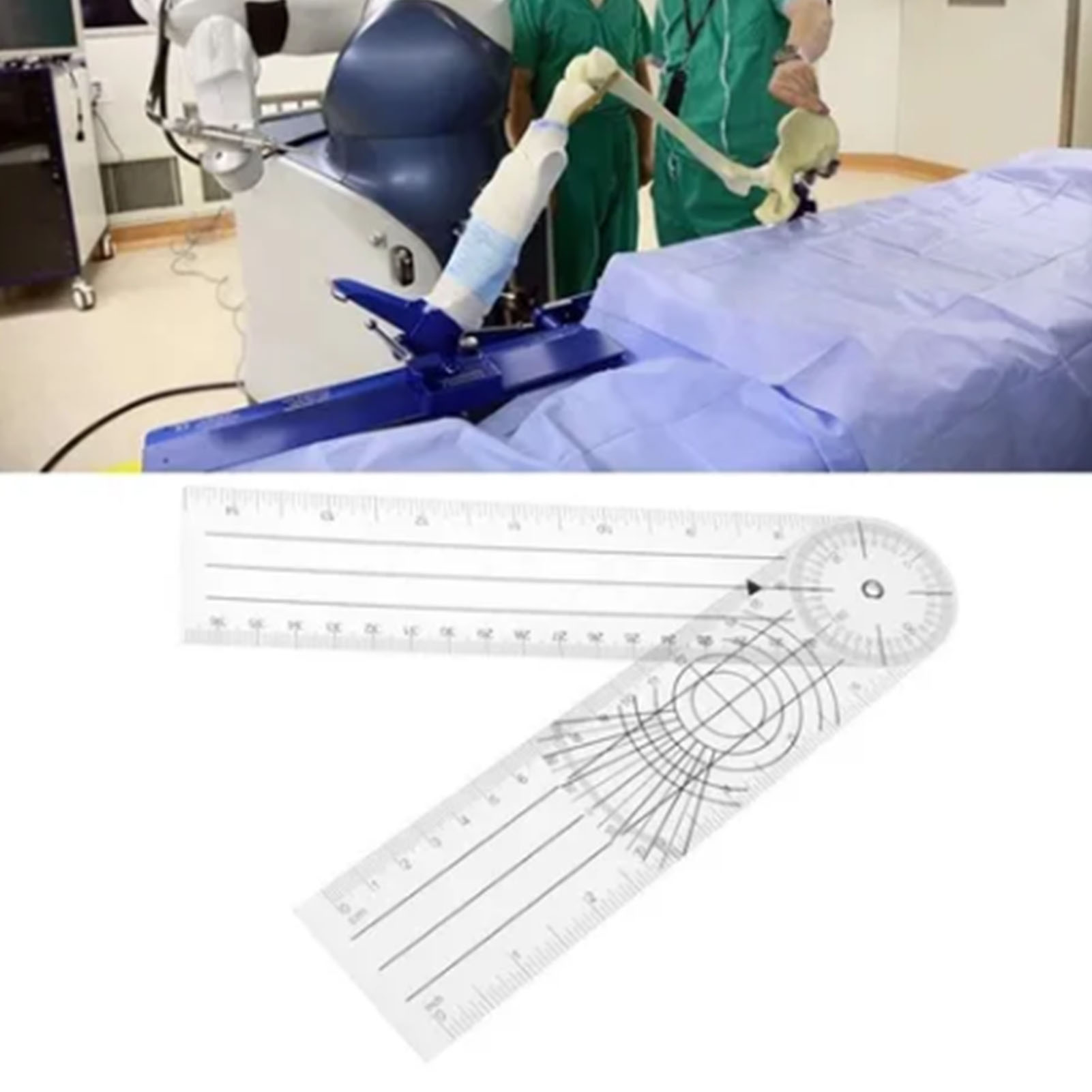 Multifunktionales Medizinisches Orthopädisches Lineal, Winkelgoniometer Zur Messung Menschlicher Gelenke Und Knochen, Präzisionsmessinstrument.