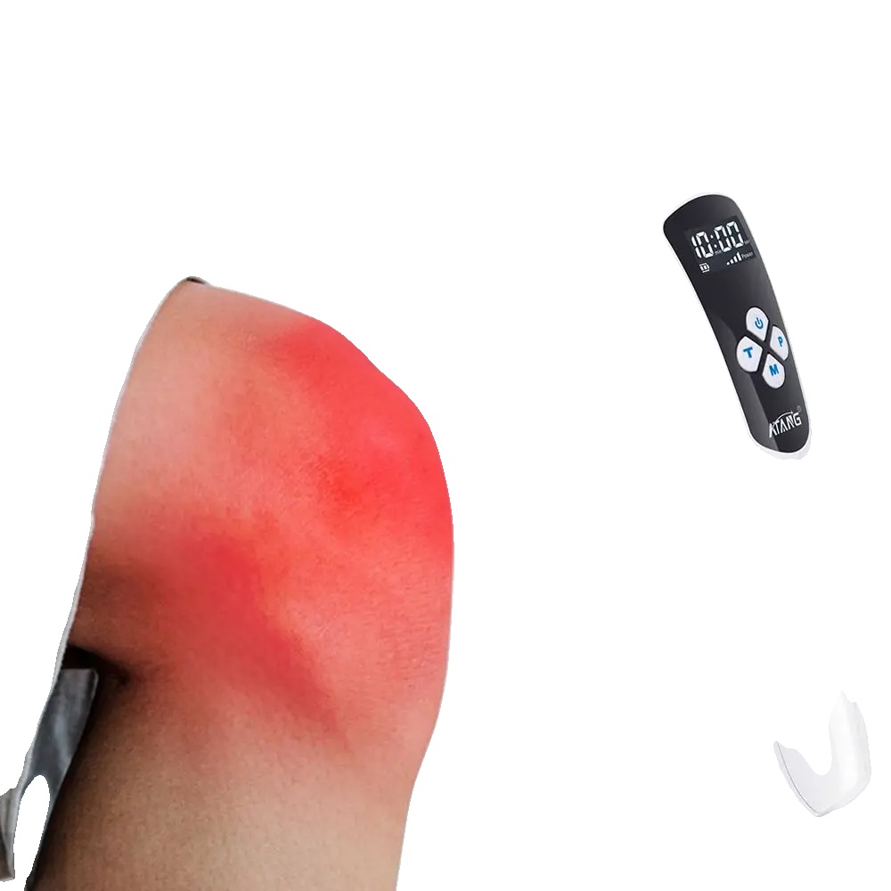 Lasertherapie Zur Schmerzlinderung Bei Rheumatoider Arthritis, 808 Nm Und 650 Nm Infrarotlaser
