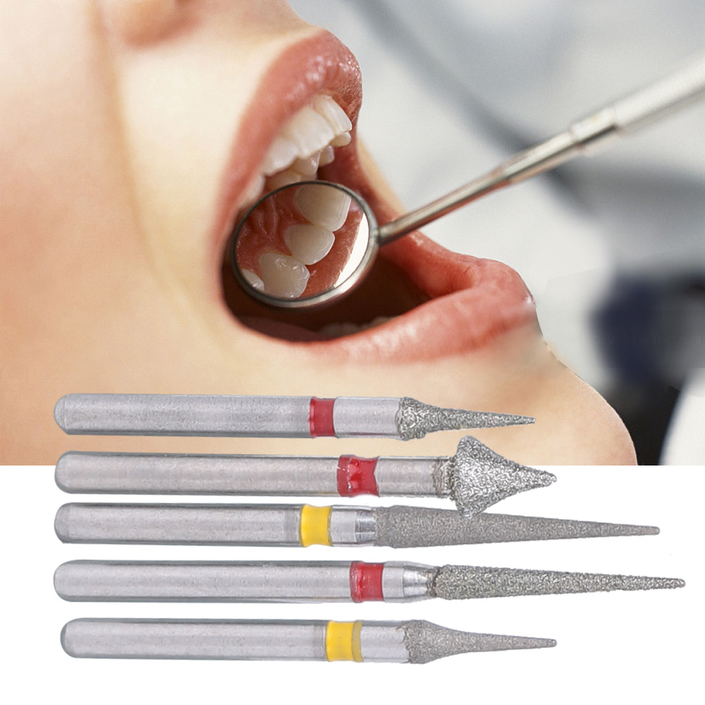 5-teiliges Set Aus Hochgeschwindigkeits-diamantbohrern Zur Schmelzpräparation Zwischen Den Zähnen In Der Kieferorthopädie, Dentallabor