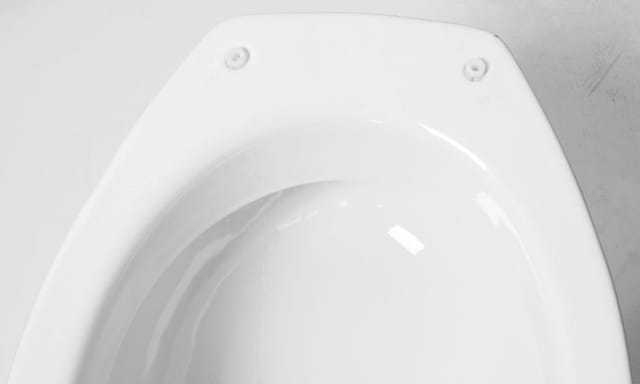 Cornat - WC-Sitz Wackelstopp Kunststoff Toilettendeckel-Befestigungen