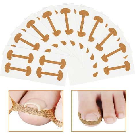 40-teiliges Nagelkorrektur-set, Nagelbettentzündungsbehandlung, Klebeband Gegen Eingewachsene Zehennägel, Elastische Baumwollaufkleber, Nagelpflaster, Zehenpflaster, Pediküre-werkzeug