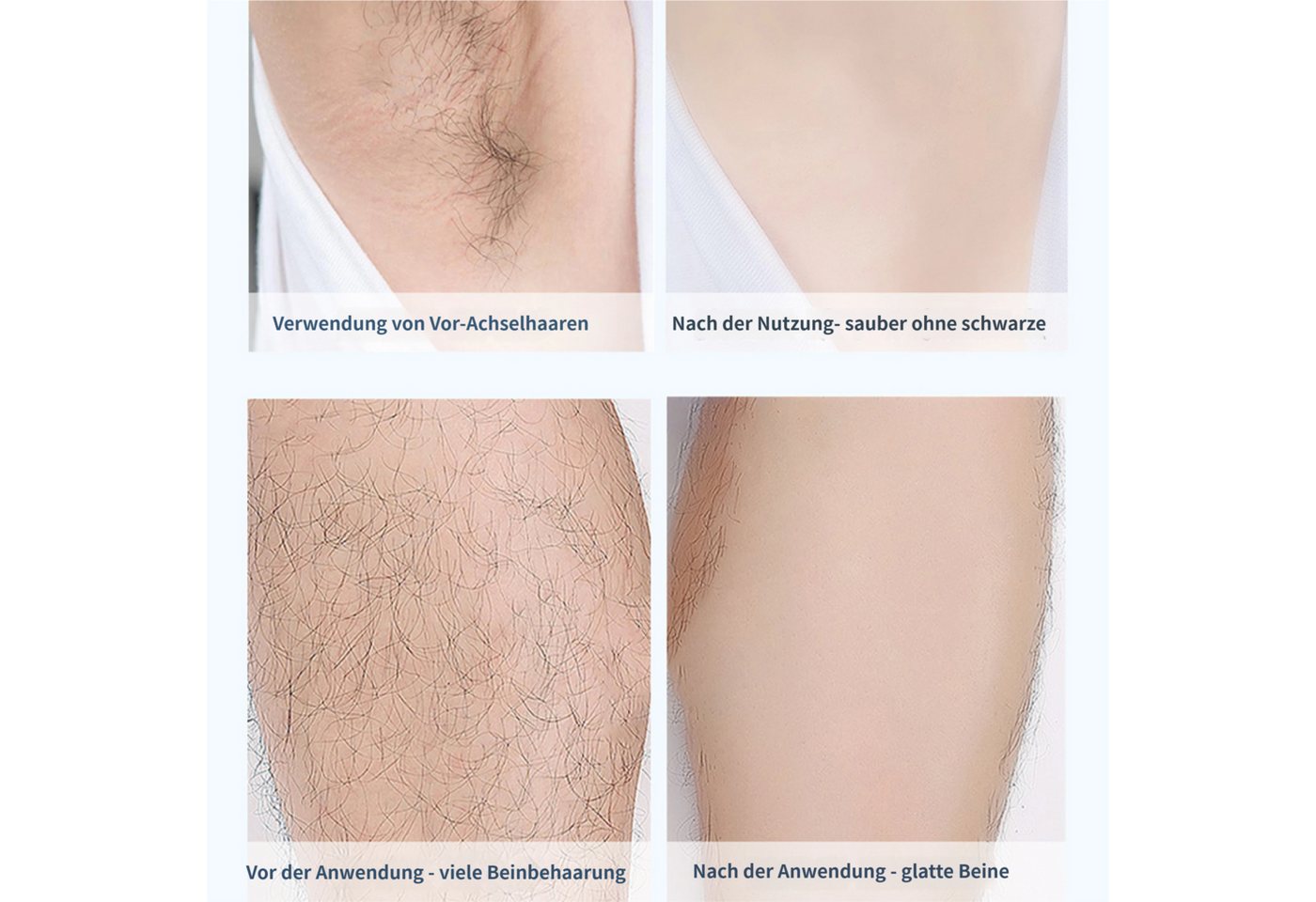 KINSI Elektrogesichtshaarentferner 5-in-1 Elektrischer Haarentferner Damen,Multifunktions Trimmer Set, Aufsätze: 5, Kurzhaarrasierkopf, Langhaartrimmerkopf, Nasenhaartrimmerkopf , Augenbrauentrimmerkopf, Ganzkörper-Rundrasierkopf, IPX7 wasserdicht,für Achseln,Beine,Nasenhaare & Bikinizone Bild 4