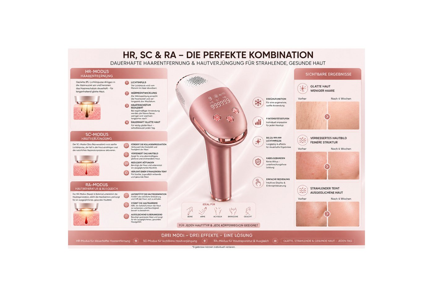Lalano`S Cosmetics IPL-Haarentferner IceSilk Pro mit Eiskühlfunktion, HR/SC/RA & Auto-Modus, 999.999 Lichtimpulse, 9 Intensitätsstufen Bild 3